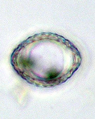 Cosmarium crenatoides